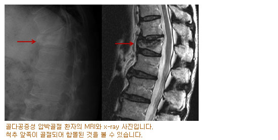 ٰ йڰ ȯ MRI x-ray Դϴ. ô  Ǿ Ը    ֽϴ.